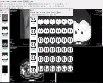 C#医学影像管理系统源码 医学影像存储与传输系统源码 PACS系统源码带三维重建